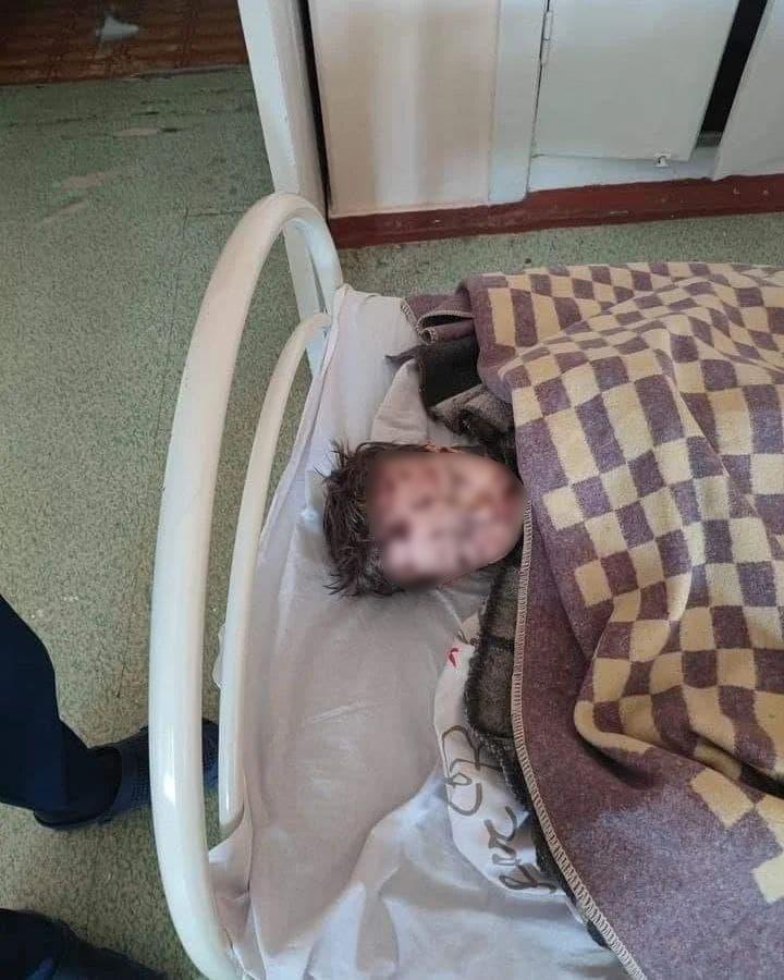  un rezident al Severodonetsk și copiii ei au fost spitalizați/photo Telegram channel of Sergei Gaidai 